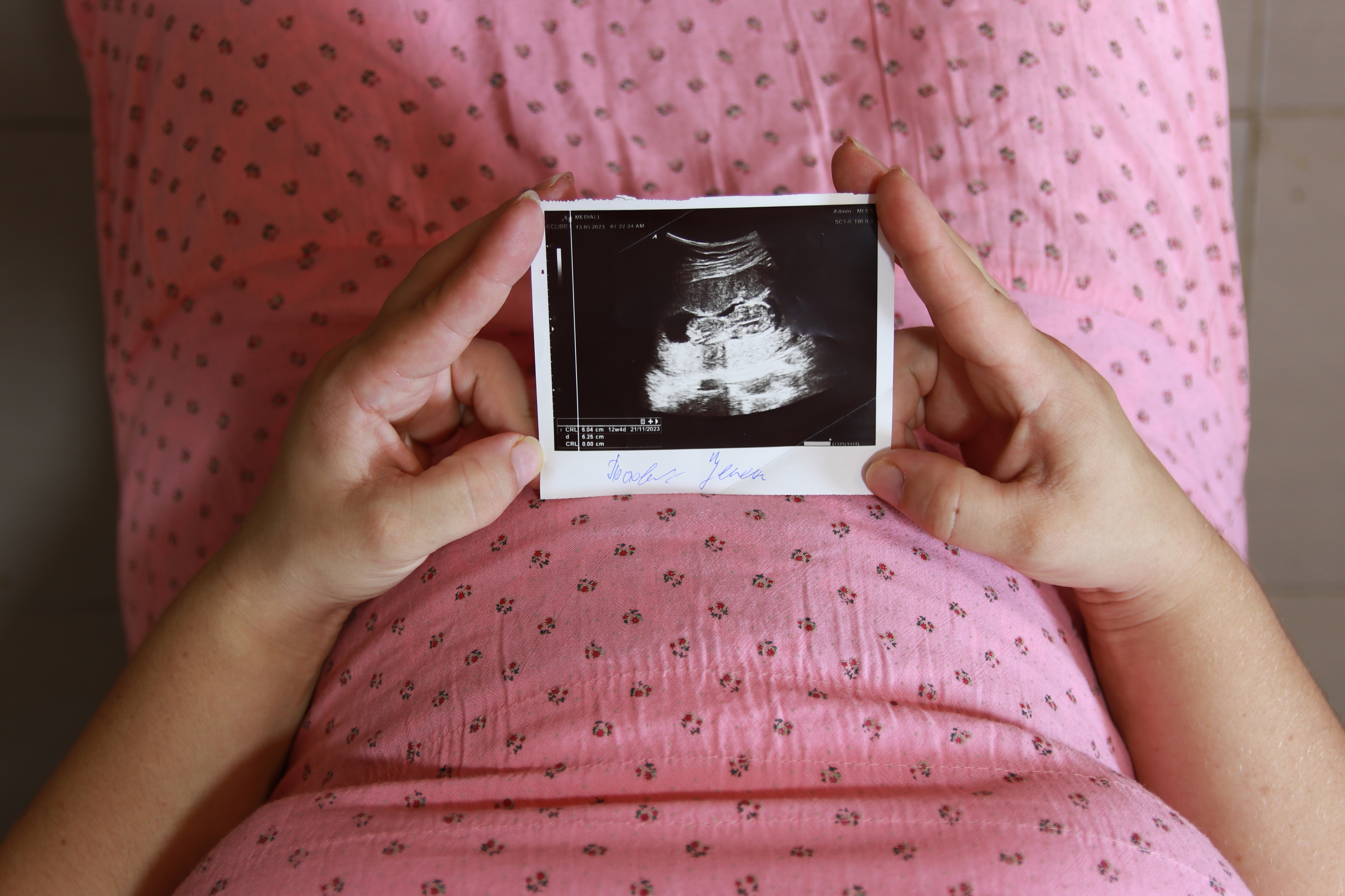 Kvinna sitter ner och håller ett ultraljudsfoto på sin bebis