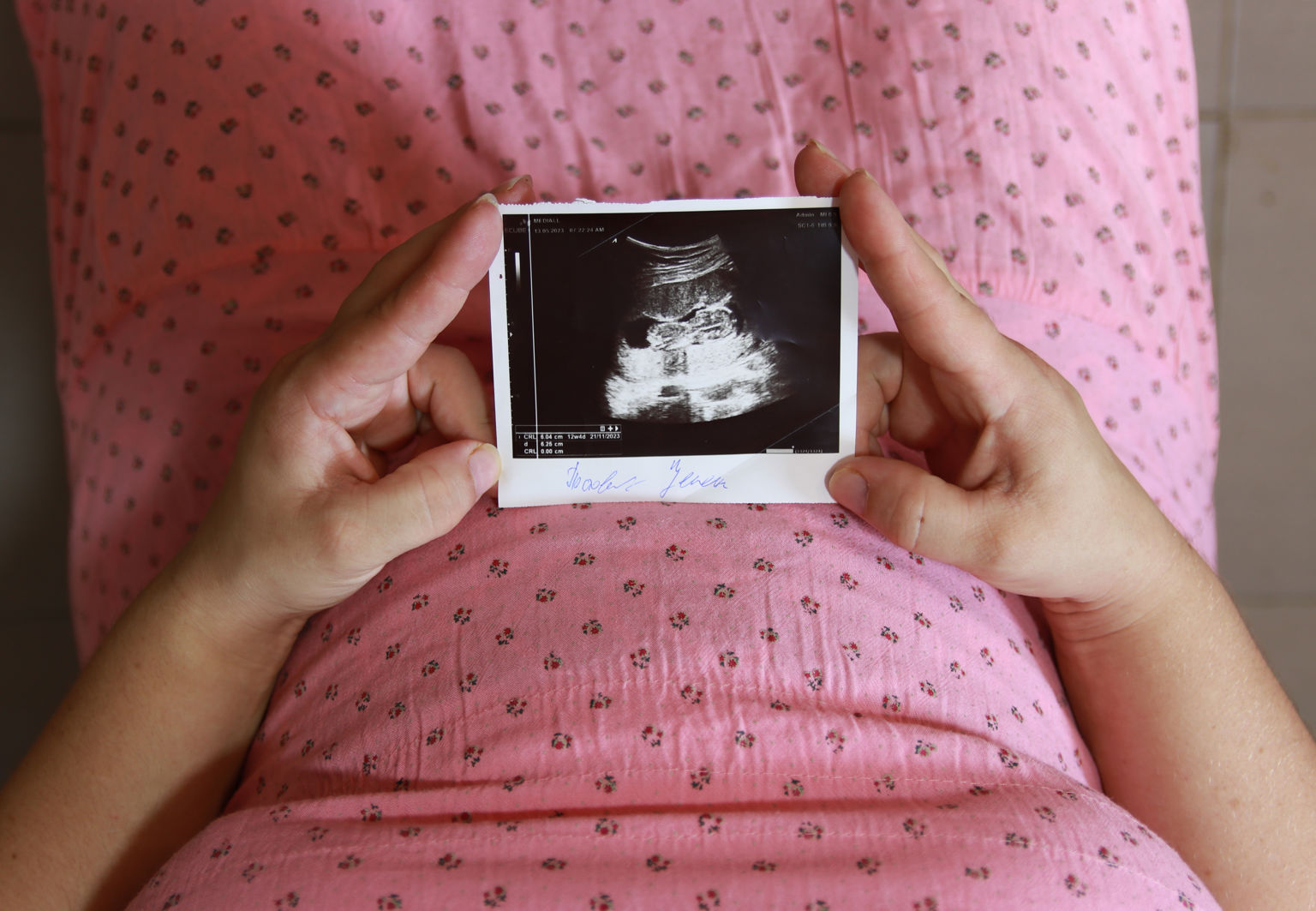 Kvinna sitter ner och håller ett ultraljudsfoto på sin bebis