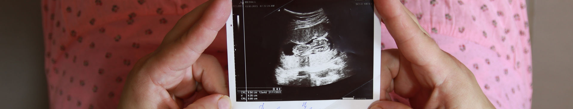 Kvinna sitter ner och håller ett ultraljudsfoto på sin bebis